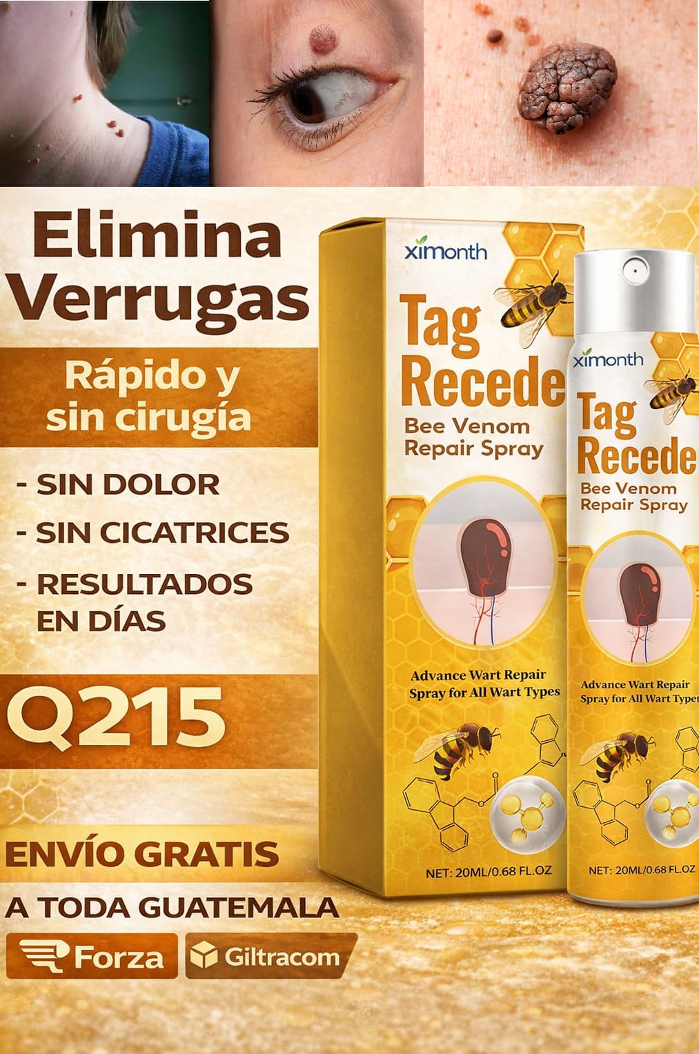 Elimina esa Verruga @squerosa